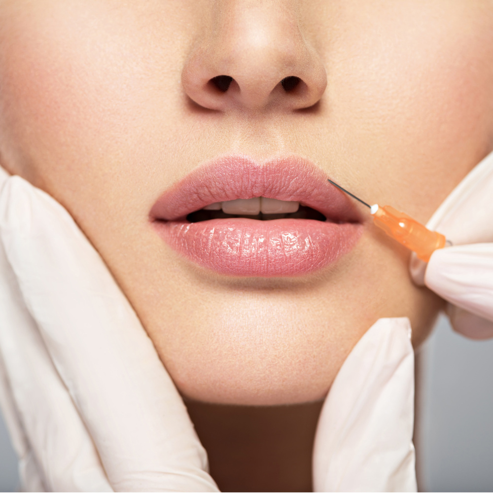 Aesthetic+Dermal+Fillers