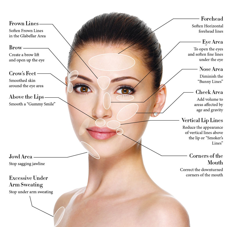 botox-anti-wrinkle-injections-dermacare-melbourne
