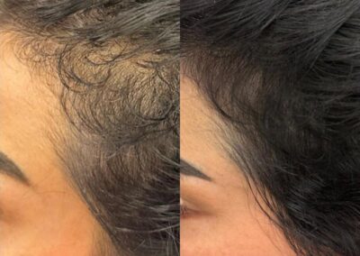 Purasomes hair and scalp complex Purasomes hair and scalp complex